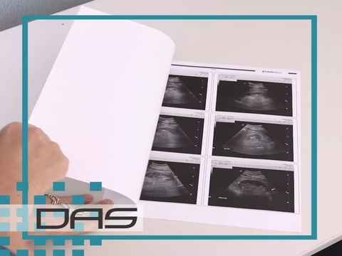 ecografia pediatrica